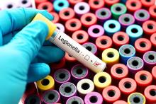 Legionnaires’ outbreak: 25 new cases in London, source traced to meat plant